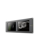 HDLSMTWSCOPEDUO4-LANG1-2e2f8db4-9f5b-4b91-b173-940cf6b26baa